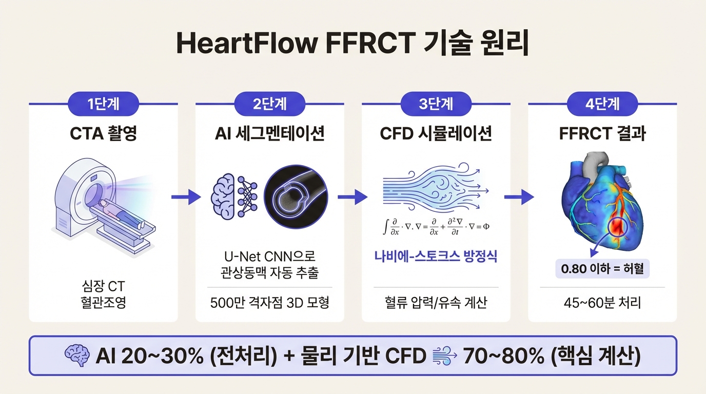 HeartFlow FFRCT 기술 원리: CTA에서 FFRCT까지 4단계 프로세스