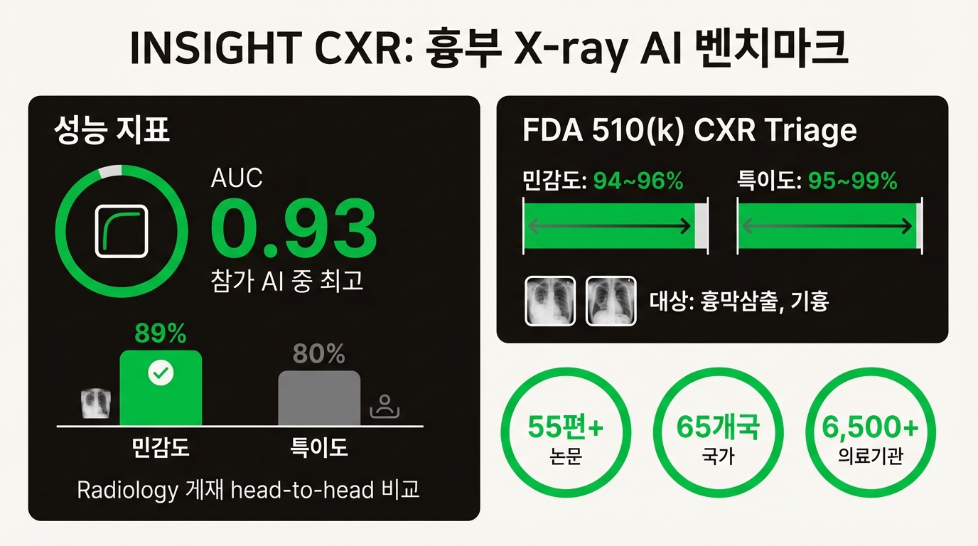 INSIGHT CXR 성능 벤치마크: AUC 0.93